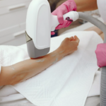 Laser Hair Removal